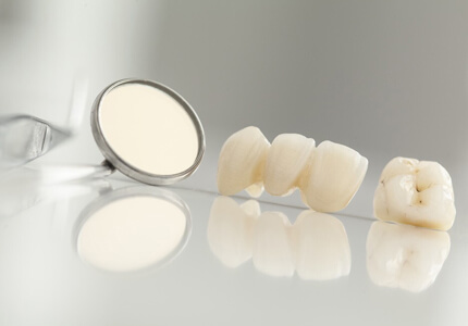dental bridges treatment in glendale az