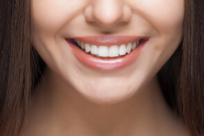 teeth whitening glendale